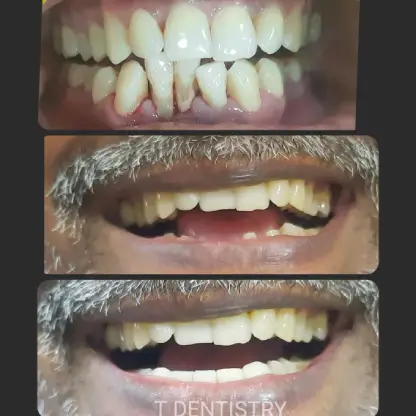 Cosmetic Dentistry in RS Puram,Coimbatore