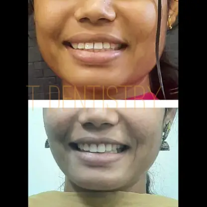 Dentist in RS Puram,Coimbatore