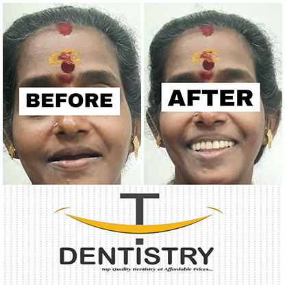 Dentist in RS Puram,Coimbatore